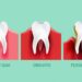Can dental crowns cause health problems